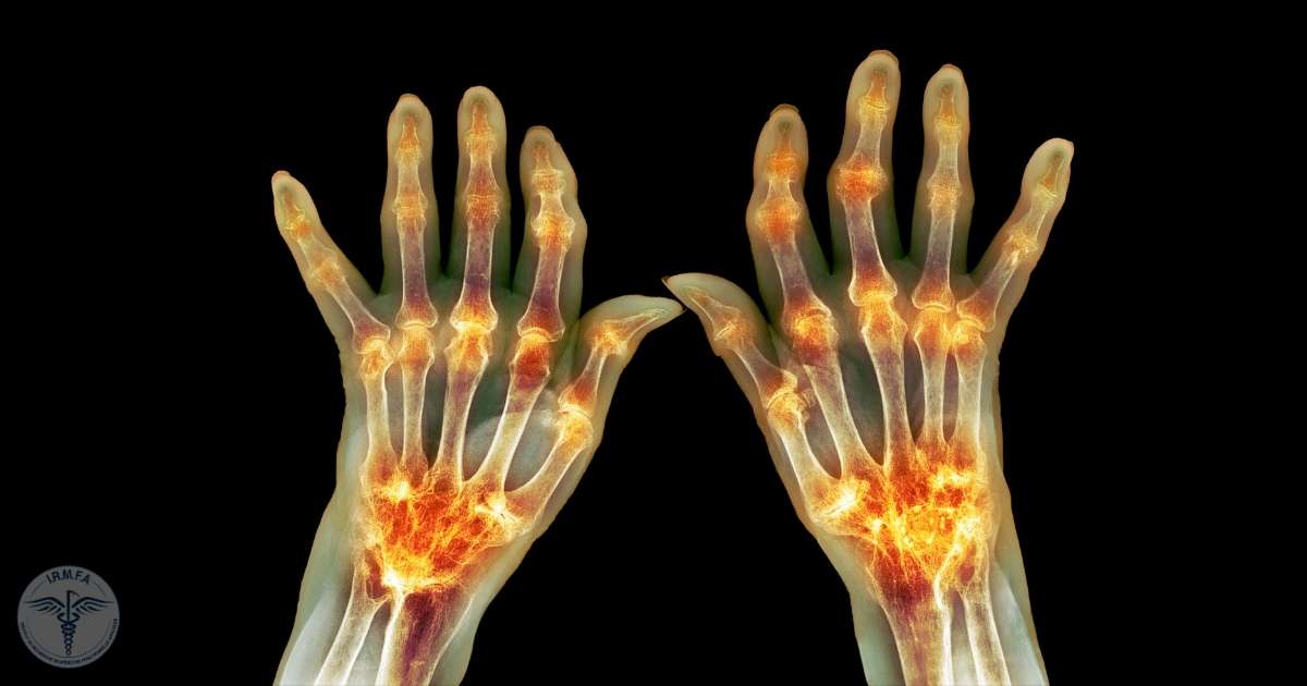 Pathologies Inflammatoires